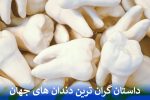 داستان گران ترین دندان های جهان