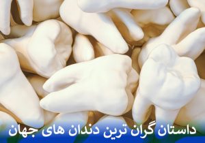 داستان گران ترین دندان های جهان