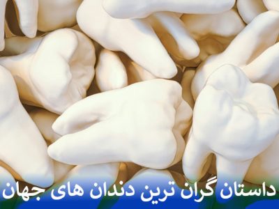 داستان گران ترین دندان های جهان
