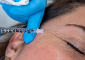 ماندگارترین روش‌های جوانسازی پوست برای افراد بالای ۴۰ سال