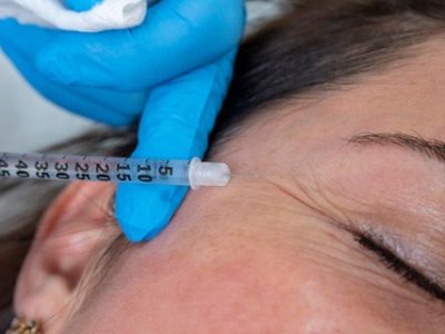 ماندگارترین روش‌های جوانسازی پوست برای افراد بالای ۴۰ سال